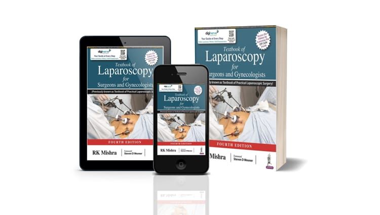 textbookoflaparoscopy